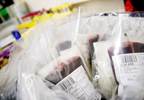 Transfusion-Transmitted Hepatitis B Virus: Minimizing the Risk Transfusion-Transmitted Hepatitis B Virus: Minimizing the Risk
