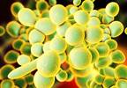 First Test to Identify <i>Candida auris</i> Gets FDA Approval First Test to Identify <i>Candida auris</i> Gets FDA Approval