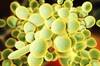 First Test to Identify <i>Candida auris</i> Gets FDA Approval First Test to Identify <i>Candida auris</i> Gets FDA Approval