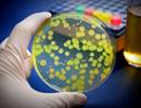 Anaerobic Bacteria in Cystic Fibrosis Airways Associated With Milder Disease Anaerobic Bacteria in Cystic Fibrosis Airways Associated With Milder Disease