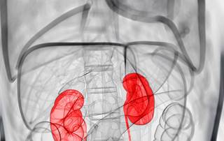 Nasopharyngitis occurred in 3 patients in the non-CKD group and 3 patients in the CKD group. Nasopharyngitis occurred in 3 patients in the non-CKD group and 3 patients in the CKD group.