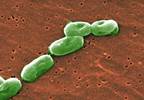 <i>Burkholderia cepacia</i> Outbreak Tied to No-Rinse Cleansing Foam <i>Burkholderia cepacia</i> Outbreak Tied to No-Rinse Cleansing Foam