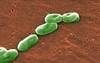 i-STAT Technology May Improve Detection of <i>Burkholderia pseudomallei</i> i-STAT Technology May Improve Detection of <i>Burkholderia pseudomallei</i>