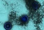 HSV-1 and HSV-2 Seroprevalence Among Pregnant Women in the United States HSV-1 and HSV-2 Seroprevalence Among Pregnant Women in the United States