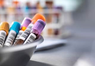 The combination of HBsAg and HBcrAg had the greatest predictive value for HBeAg seroconversion. The combination of HBsAg and HBcrAg had the greatest predictive value for HBeAg seroconversion.