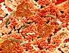 The Role of Dietary Trehalose in the <i>Clostridium difficile</i> Epidemic The Role of Dietary Trehalose in the <i>Clostridium difficile</i> Epidemic