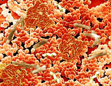 The Role of Dietary Trehalose in the Clostridium difficile Epidemic The Role of Dietary Trehalose in the Clostridium difficile Epidemic