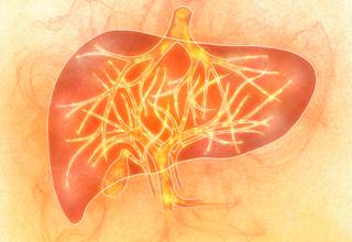 Serum M2BPGi is a reliable marker for assessing liver fibrosis in patients with chronic hepatitis B virus infection. Serum M2BPGi is a reliable marker for assessing liver fibrosis in patients with chronic hepatitis B virus infection.