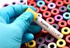 Increasing Incidence of Syphilis in People With HIV Increasing Incidence of Syphilis in People With HIV
