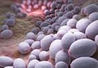 Isavuconazole Not Noninferior to Caspofungin for Invasive Candida Infections Isavuconazole Not Noninferior to Caspofungin for Invasive Candida Infections