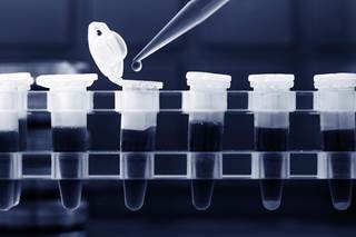Factors associated with elevated risk for progression to TB include age, sex, HIV, and especially being in recent contact with a patient with active pulmonary TB. Factors associated with elevated risk for progression to TB include age, sex, HIV, and especially being in recent contact with a patient with active pulmonary TB.