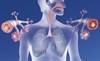 COPD Frequently Misdiagnosed, Undiagnosed in Individuals Infected With HIV COPD Frequently Misdiagnosed, Undiagnosed in Individuals Infected With HIV