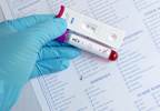 HCV Guidelines Updated to Include Recommendations for Key Populations HCV Guidelines Updated to Include Recommendations for Key Populations