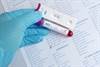 HCV Guidelines Updated to Include Recommendations for Key Populations HCV Guidelines Updated to Include Recommendations for Key Populations