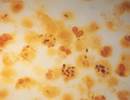 Worse Outcomes From Legionella Pneumonia in Individuals With Advanced HIV Worse Outcomes From Legionella Pneumonia in Individuals With Advanced HIV