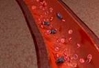 Case Volume Affects Sepsis Mortality in Immunosuppressed Patients Case Volume Affects Sepsis Mortality in Immunosuppressed Patients