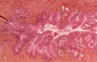 The cancer centers also encourage completion of the recommended HPV vaccine series by age 26 among those not previously vaccinated. The cancer centers also encourage completion of the recommended HPV vaccine series by age 26 among those not previously vaccinated.