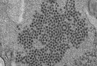 EV-D58 was the most frequently reported enterovirus between 2014 and 2016. <i>Photo Credit: CDC/ Cynthia S. Goldsmith, Yiting Zhang</I> EV-D58 was the most frequently reported enterovirus between 2014 and 2016. <i>Photo Credit: CDC/ Cynthia S. Goldsmith, Yiting Zhang</I>