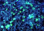 Aberrant Epstein-Barr Virus Response Associated With Schizophrenia Aberrant Epstein-Barr Virus Response Associated With Schizophrenia