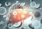 Risk for Liver Cirrhosis in Methorexate-Treated Psoriasis With Chronic Viral Hepatitis Risk for Liver Cirrhosis in Methorexate-Treated Psoriasis With Chronic Viral Hepatitis