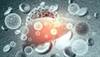 Risk for Liver Cirrhosis in Methorexate-Treated Psoriasis With Chronic Viral Hepatitis Risk for Liver Cirrhosis in Methorexate-Treated Psoriasis With Chronic Viral Hepatitis
