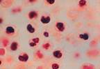 Increase in VA Legionnaires' Disease Rates From 2014 to 2016 Increase in VA Legionnaires' Disease Rates From 2014 to 2016