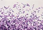 Should Metronidazole Be Recommended for Mild Clostridium difficile Infections? Should Metronidazole Be Recommended for Mild Clostridium difficile Infections?