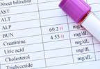 Re-Assessing Renal Dose Adjustments of Antibiotics: Expert Q&A Re-Assessing Renal Dose Adjustments of Antibiotics: Expert Q&A