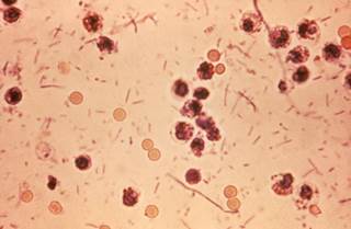 The CDC has also identified an increasing number of <i>Shigella isolates</i> with azithromycin MICs that exceed the epidemiologic cutoff value. <Photo Credit: CDC</i> The CDC has also identified an increasing number of <i>Shigella isolates</i> with azithromycin MICs that exceed the epidemiologic cutoff value. <Photo Credit: CDC</i>