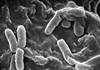 <i>Pseudomonas</i> Associated With Frequent Hospitalizations Due to COPD Exacerbations <i>Pseudomonas</i> Associated With Frequent Hospitalizations Due to COPD Exacerbations