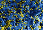 The Role of Viral Infections and Vaccines in the Pathogenesis of Antiphospholipid Syndrome The Role of Viral Infections and Vaccines in the Pathogenesis of Antiphospholipid Syndrome