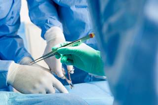Treatment of HCV with sofosbuvir/ledipasvir ± ribavirin after liver or renal transplantation is safe and effective. Treatment of HCV with sofosbuvir/ledipasvir ± ribavirin after liver or renal transplantation is safe and effective.