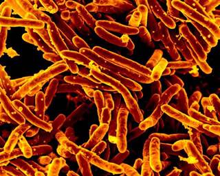 An analysis of 19 articles found that 3HP was as safe and effective as other recommended latent TB infection regimens. <i>Photo Credit: CDC PHIL/NIAID</i> An analysis of 19 articles found that 3HP was as safe and effective as other recommended latent TB infection regimens. <i>Photo Credit: CDC PHIL/NIAID</i>