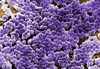 Is New Surveillance Monitoring Required for Enterococcal Oxazolidinone Resistance? Is New Surveillance Monitoring Required for Enterococcal Oxazolidinone Resistance?