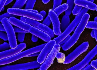 This was the largest E. coli food poisoning outbreak in the United States in more than a decade. <i> Photo credit: National Institute of Allergy and Infectious Diseases (NIAID)</i> This was the largest E. coli food poisoning outbreak in the United States in more than a decade. <i> Photo credit: National Institute of Allergy and Infectious Diseases (NIAID)</i>