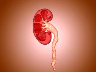 Circumcision was associated with decreased risk of UTI in boys with hydronephrosis. Circumcision was associated with decreased risk of UTI in boys with hydronephrosis.