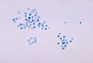 Single high-dose liposomal amphotericin B treatment was non-inferior to standard dose 14-day amphotericin B treatment.<i> Photo credit: CDC/ Dr. Leanor Haley </i> Single high-dose liposomal amphotericin B treatment was non-inferior to standard dose 14-day amphotericin B treatment.<i> Photo credit: CDC/ Dr. Leanor Haley </i>