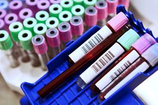 In absence of HIV RNA assay accessibility, ARCHITECT assay may provide sufficient evidence for false positives. In absence of HIV RNA assay accessibility, ARCHITECT assay may provide sufficient evidence for false positives.
