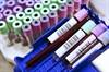 ARCHITECT HIV Ag/Ab Assay Signal-to-Cutoff Ratio Useful in Assessing Low-Risk Pregnant Women ARCHITECT HIV Ag/Ab Assay Signal-to-Cutoff Ratio Useful in Assessing Low-Risk Pregnant Women