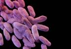 Abx-Resistant Enterobacteriaceae Tied to Clinical Failure in UTI Abx-Resistant Enterobacteriaceae Tied to Clinical Failure in UTI