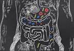 Probiotic Use May Not Protect Against Clostridium Difficile Infection Probiotic Use May Not Protect Against Clostridium Difficile Infection