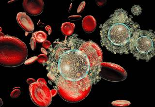 Cardiovascular mortality was predicted by protease inhibitor use, coronary artery disease, pulmonary artery systolic pressure, and immunosuppression. Cardiovascular mortality was predicted by protease inhibitor use, coronary artery disease, pulmonary artery systolic pressure, and immunosuppression.