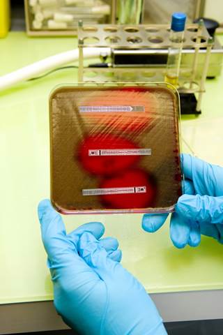 Investigators assert that difficult-to-treat resistance is a novel classifier of antimicrobial coresistance that integrates the effect of resistance on antibiotic choices. Investigators assert that difficult-to-treat resistance is a novel classifier of antimicrobial coresistance that integrates the effect of resistance on antibiotic choices.