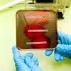 New Designation for Some Gram-Negative Bacteremia Increases Treatment Options New Designation for Some Gram-Negative Bacteremia Increases Treatment Options