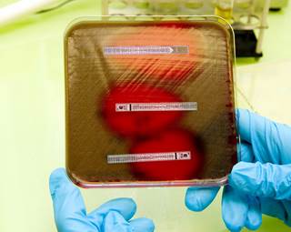 A new multi-drug resistant clone of Escherichia coli — ST1193 — has emerged in multiple US cities. <i>Photo Credit: Medical Images/BSIP</i> A new multi-drug resistant clone of Escherichia coli — ST1193 — has emerged in multiple US cities. <i>Photo Credit: Medical Images/BSIP</i>