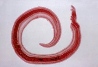 Previous research has indicated that the presence of schistosome infection increased the risk for HIV and raising HIV viral concentrations. <i>Credit:E.R. Degginger/Science Source</i> Previous research has indicated that the presence of schistosome infection increased the risk for HIV and raising HIV viral concentrations. <i>Credit:E.R. Degginger/Science Source</i>