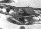 A Pan-Tuberculosis Regimen: The Debate Continues A Pan-Tuberculosis Regimen: The Debate Continues