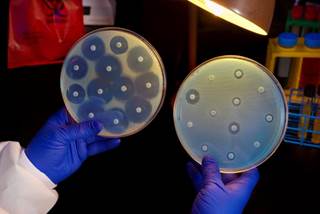 The initial course of antibiotic therapy was discordant with the isolate’s susceptibility in nearly half of the participants, 26 of 56 cases. <i>Photo Credit: CDC/ Melissa Dankel</i> The initial course of antibiotic therapy was discordant with the isolate’s susceptibility in nearly half of the participants, 26 of 56 cases. <i>Photo Credit: CDC/ Melissa Dankel</i>
