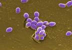 Ampicillin Plus Ceftriaxone: An Effective Alternative for <i>E faecalis</i> Infective Endocarditis Ampicillin Plus Ceftriaxone: An Effective Alternative for <i>E faecalis</i> Infective Endocarditis