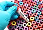 Clinical Significance of the Isolated Anti-HBc Serologic Pattern Clinical Significance of the Isolated Anti-HBc Serologic Pattern
